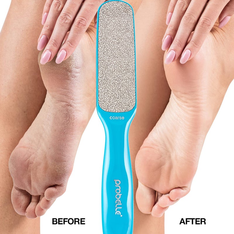 Probelle Double Sided Multidirectional Nickel Foot File Callus Remover - Immediately Reduces calluses and Corns to Powder for Instant Results  Safe Tool (Blue) - Image 4